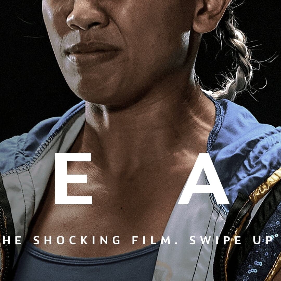 Awareness Campaign For Spca Singapore