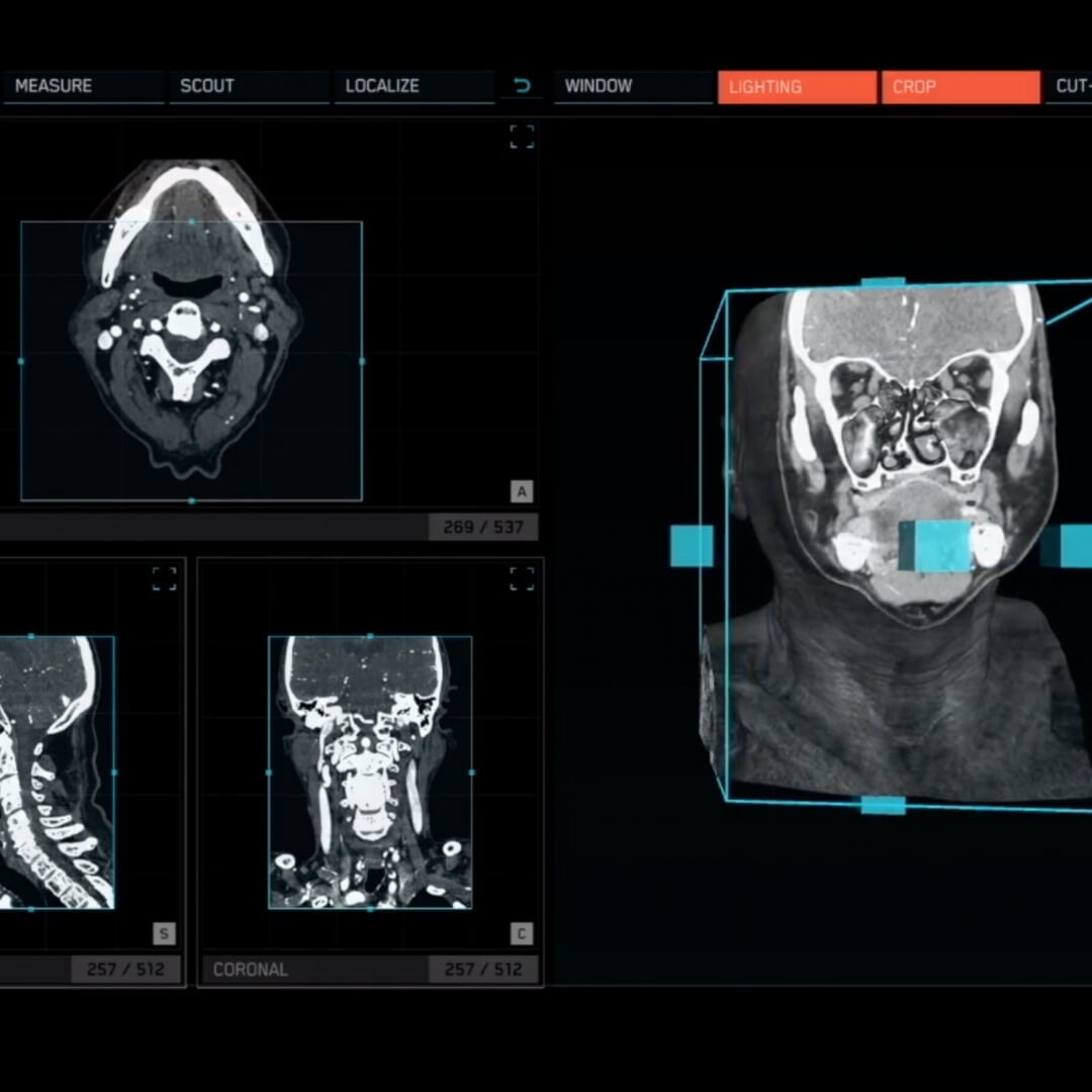 User Interface Design for 3D Surgical Applications